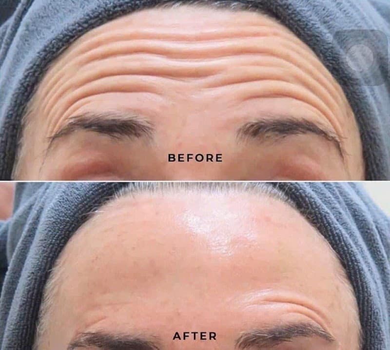 Vân Nguyễn Spa Thủ Dầu Một photo