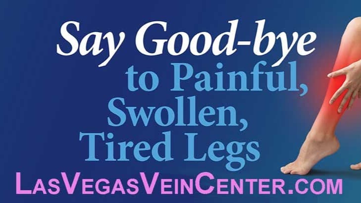 Varicous Veins Las Vegas photo