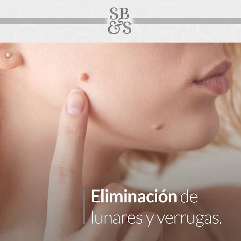 Varuny SKIN Puebla photo
