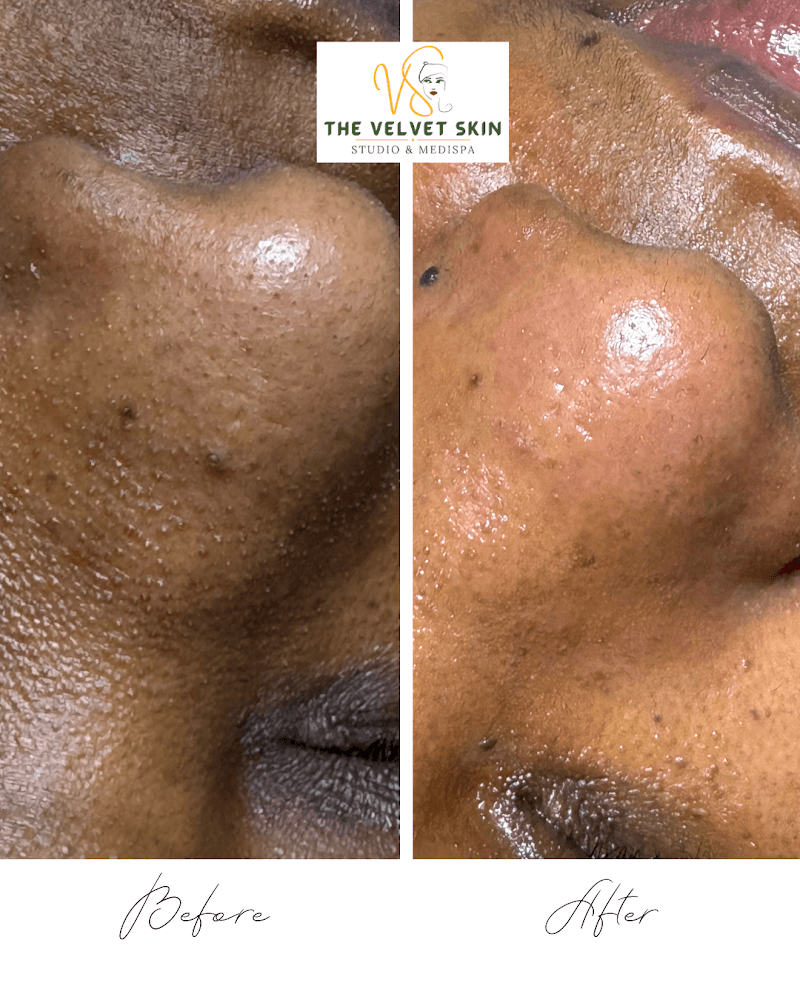 Velvet Skin Studio San Jose photo