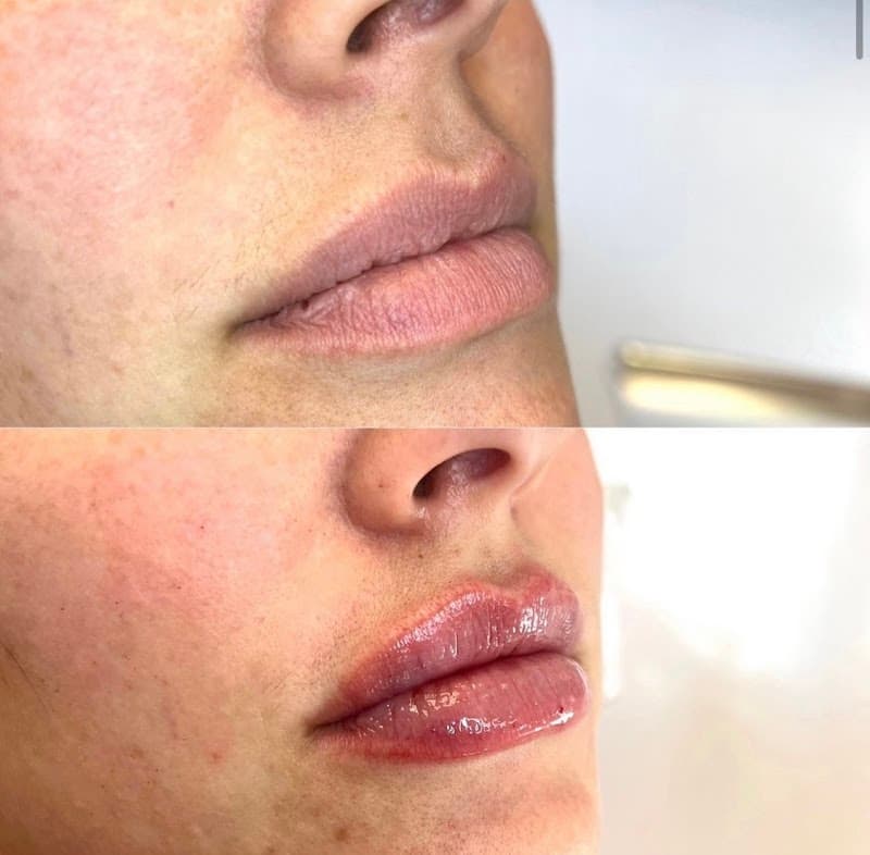 Vibrant Skin Care Boulder photo