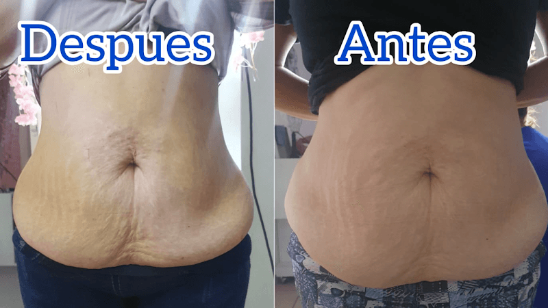 Victoria Miramar Spa Zapopan photo