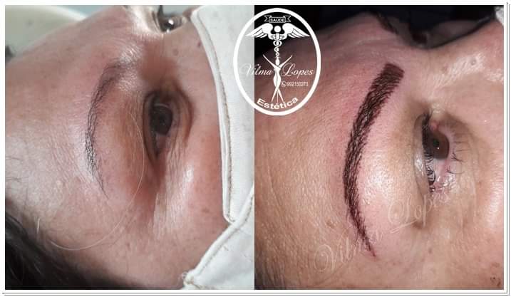 Vilma Lopes Estética e Cia Carmo do Paranaíba photo