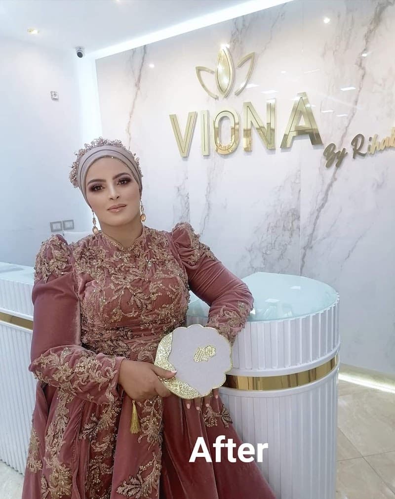 Viona Beauty Center&Spa By Rihab Rue haffouz photo