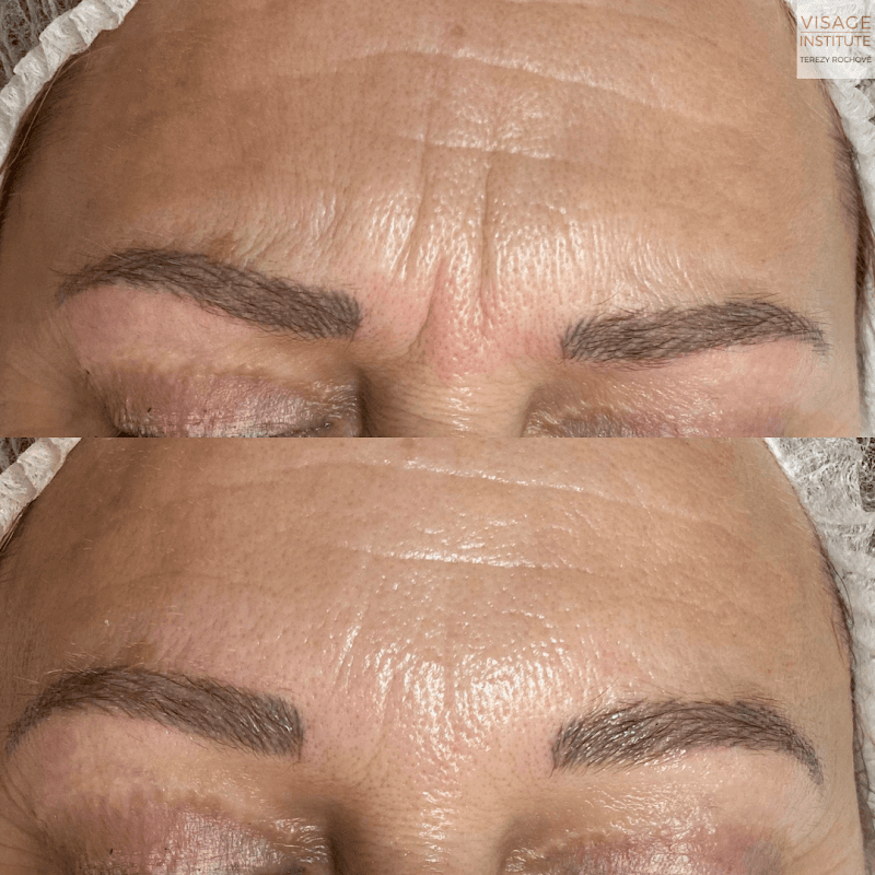 Visage Institute Terezy Rochove Uherský Brod photo