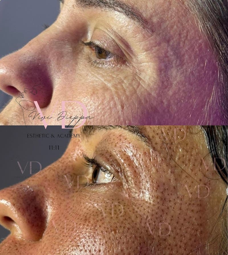 Vivi Dieppa Esthetic & Academy Doral photo