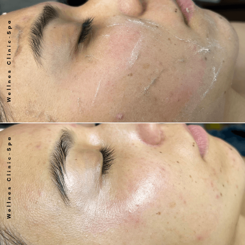 VL SPA San Luis Potosí photo