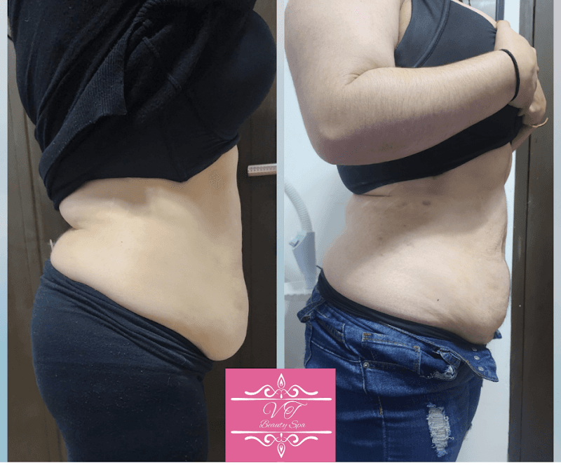 VTbeautyspa Pesquería photo