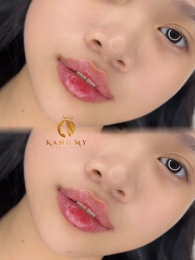 VTM Quốc Tế KangMy Chuyên Mí Đẹp Quận 7 photo