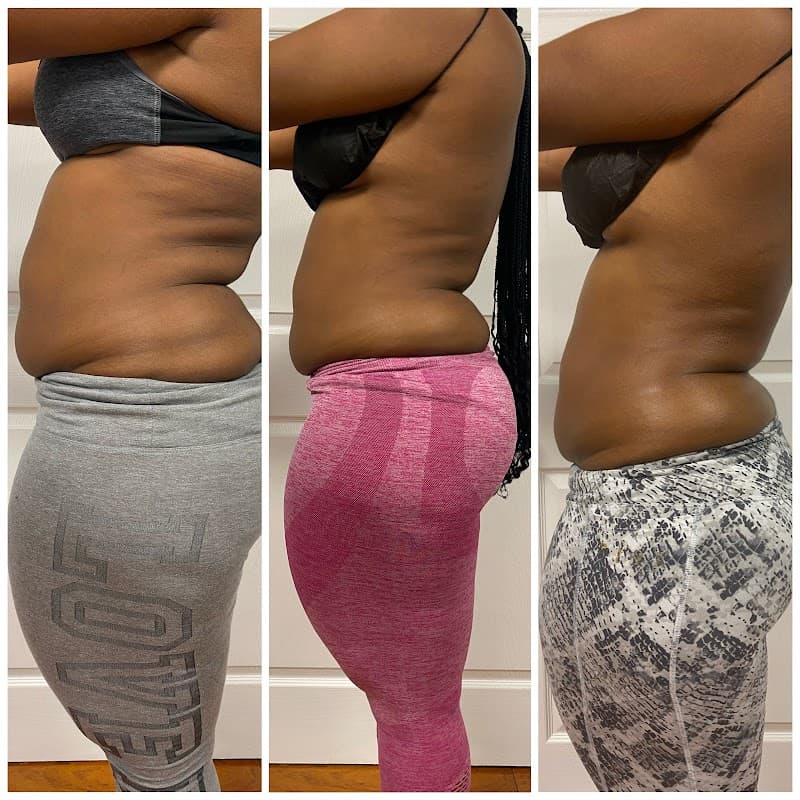 Westchester Body Sculpting Thornwood photo