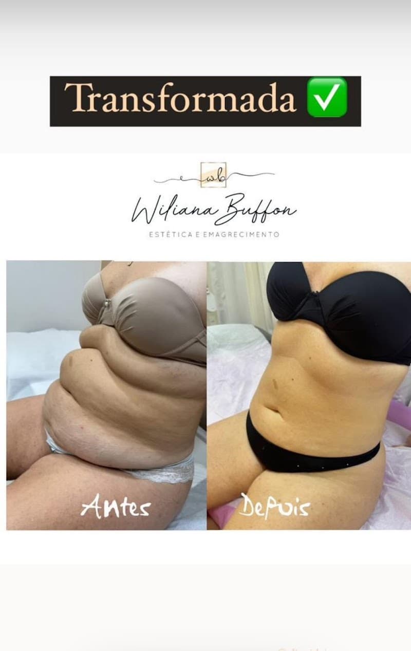 Wiliana Buffon Estética e Emagrecimento Linhares photo