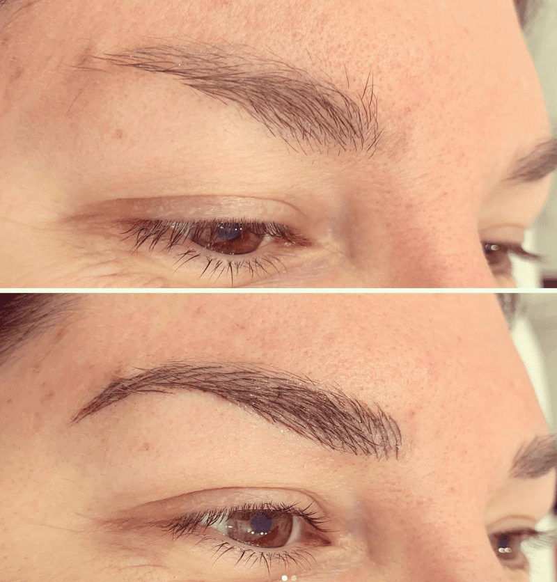 Willow's Skin and Laser Bar Cochrane photo