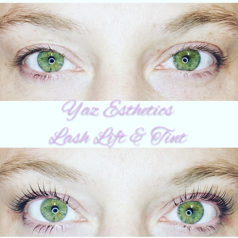 Yaz Esthetics Edina photo