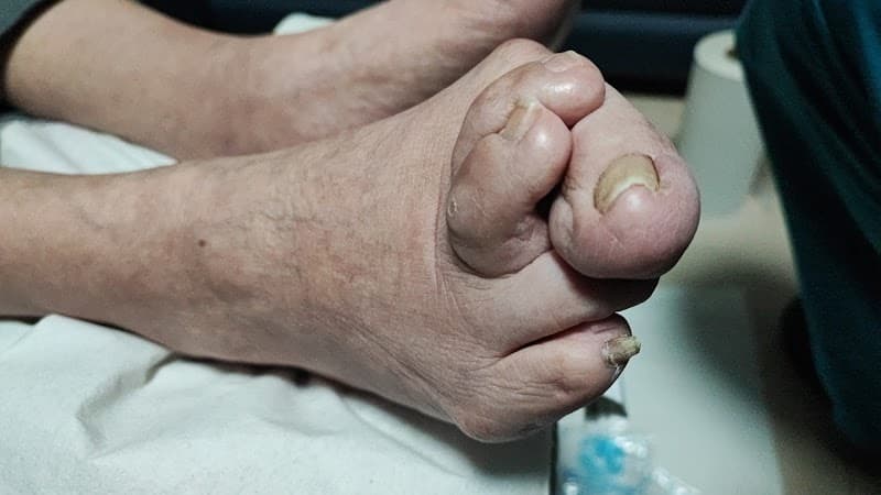 Yegopies Naucalpan de Juárez photo