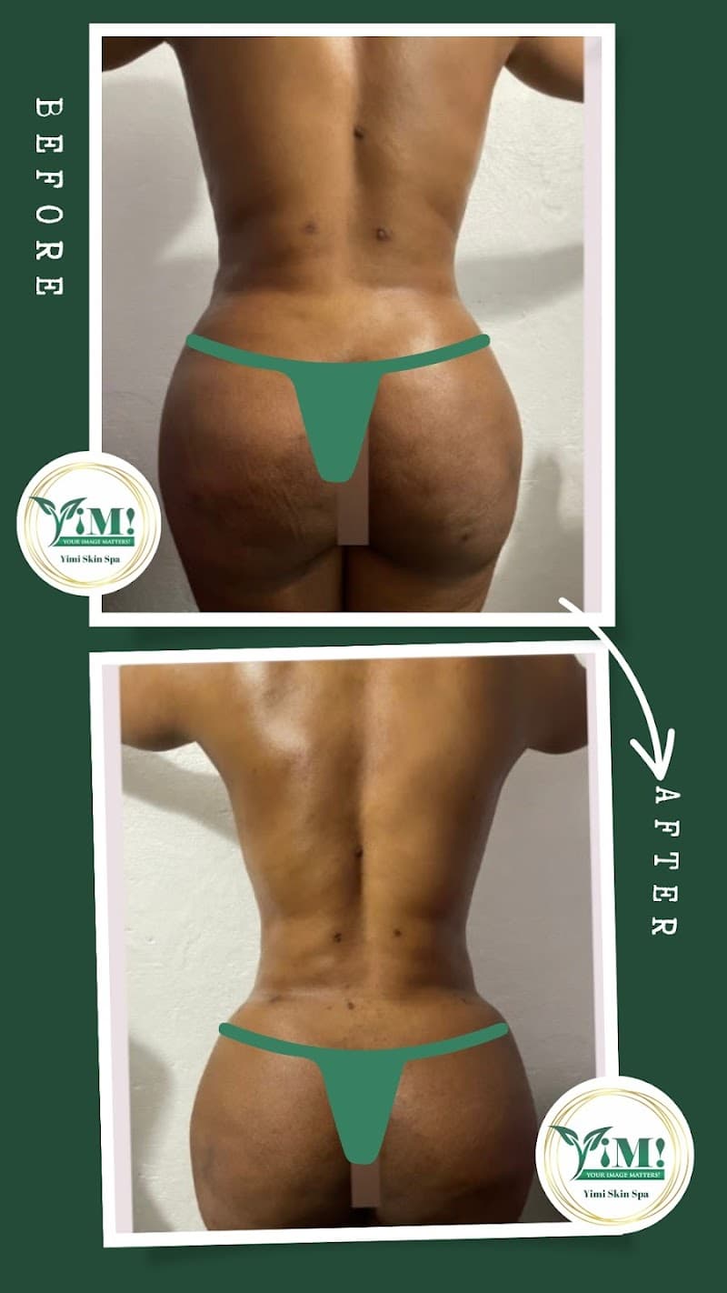 Yimi Skin Spa Pearland photo