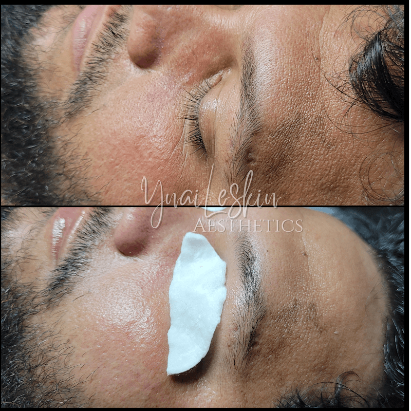 YnaiLeskin Aesthetics Palm Harbor photo