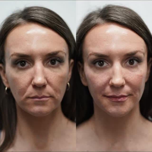 Young Medical Spa King Of Prussia photo