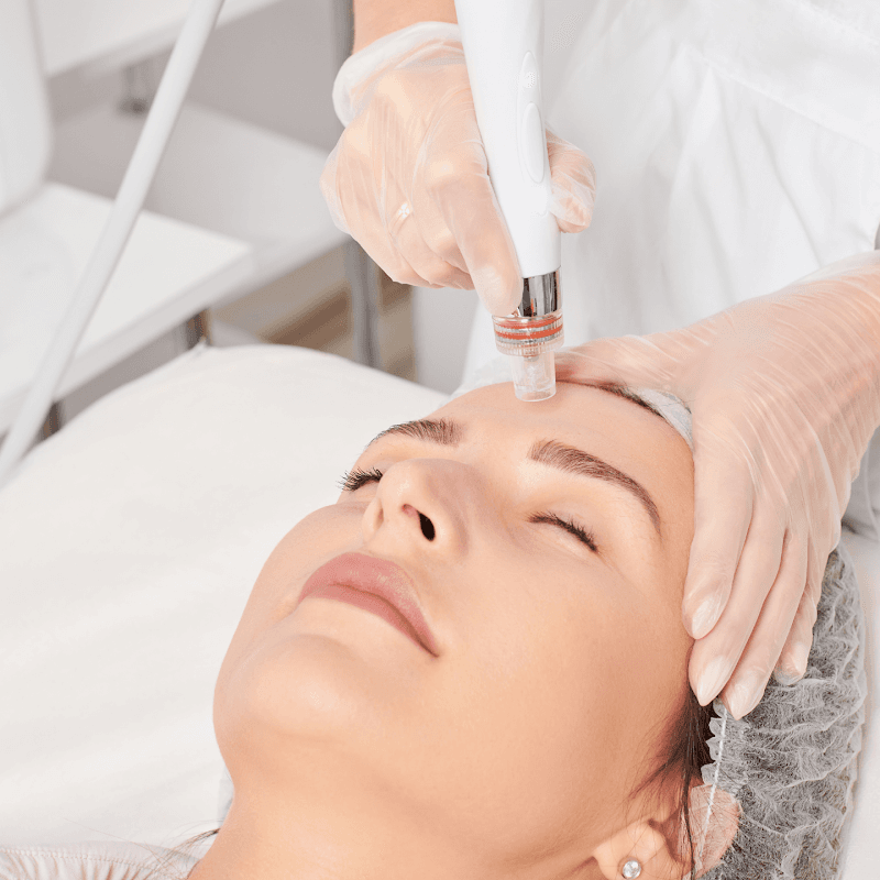 Your Perfect Skin Burlington photo