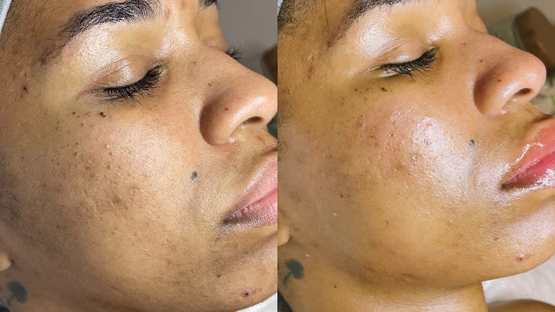 Yumi Skin Care Philadelphia photo