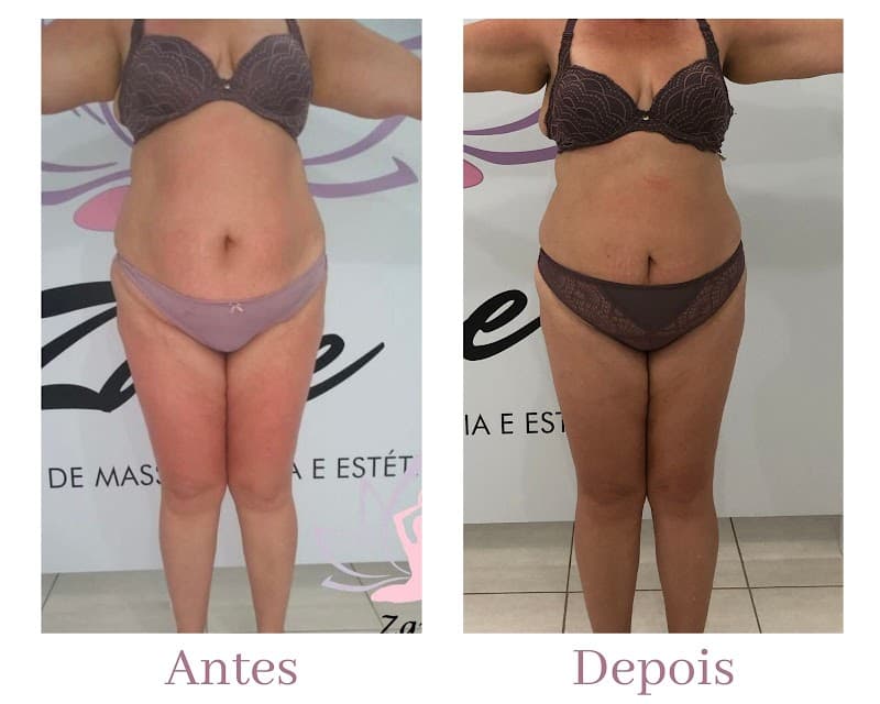 Zane - Clinica de Massoterapia e Estética Joinville photo